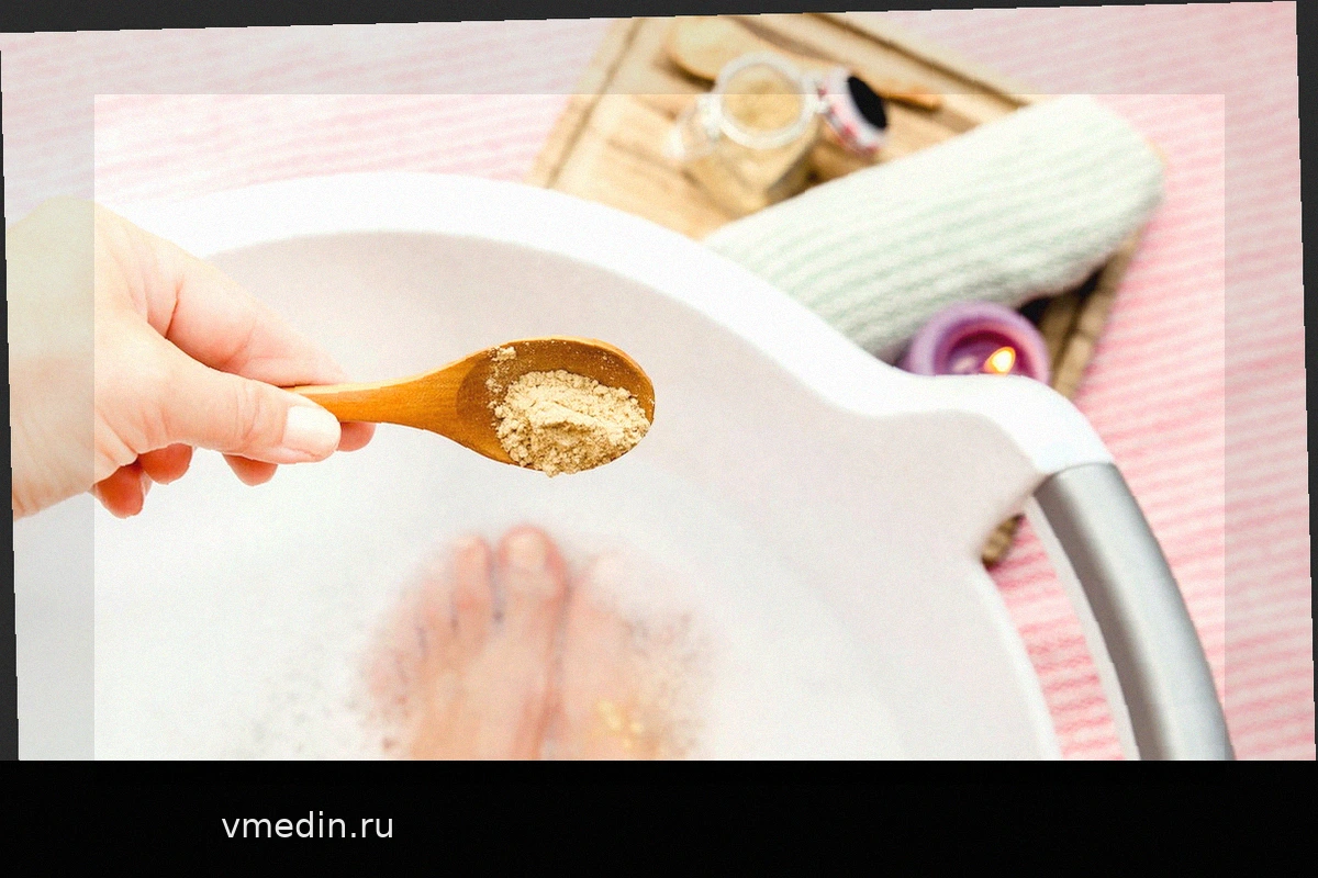 10 способов снять отек с ног и лодыжек (и когда обратиться к врачу)