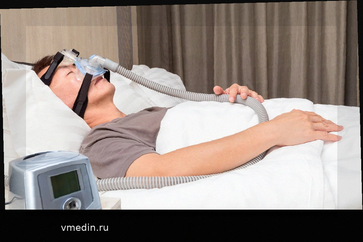 BiPAP: что это, для чего применяется и как использовать