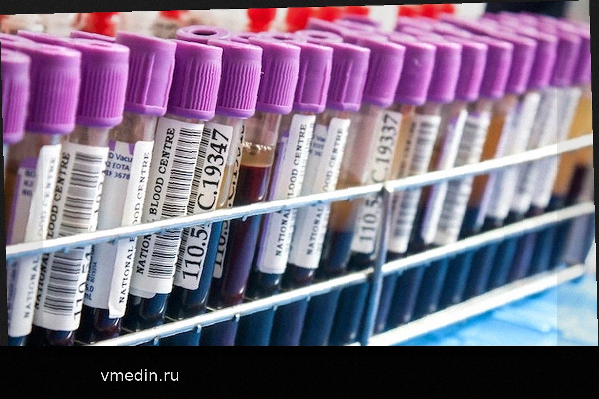 ФСГ: что это, для чего нужен и почему повышен или понижен